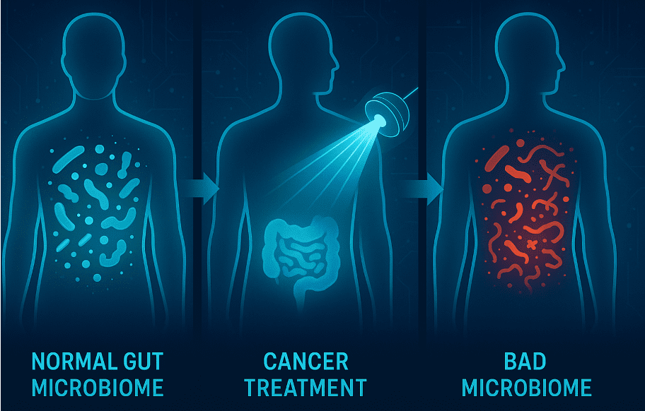 Normal gut microbiome, cancer treatment, bad microbiome